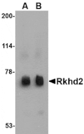 Western blot - Rkhd2 Antibody from Signalway Antibody (24778) - Antibodies.com