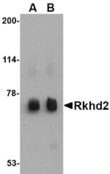 Western blot - Rkhd2 Antibody from Signalway Antibody (24778) - Antibodies.com