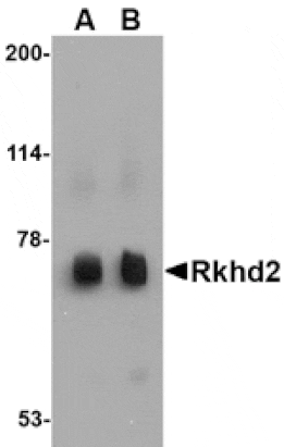 Western blot - Rkhd2 Antibody from Signalway Antibody (24778) - Antibodies.com