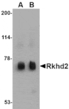 Western blot - Rkhd2 Antibody from Signalway Antibody (24778) - Antibodies.com