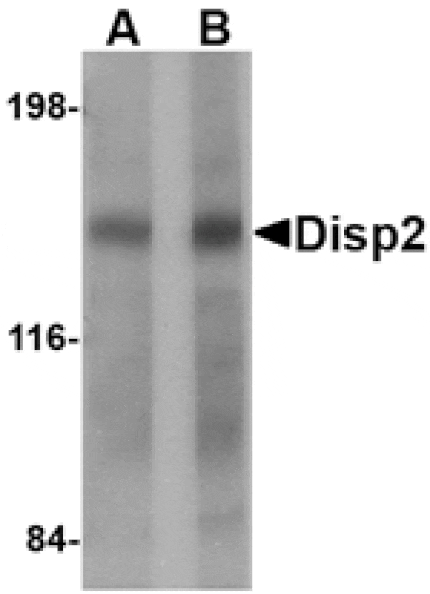 Western blot - Disp2 Antibody from Signalway Antibody (24787) - Antibodies.com