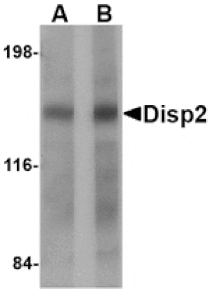 Western blot - Disp2 Antibody from Signalway Antibody (24787) - Antibodies.com