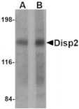 Western blot - Disp2 Antibody from Signalway Antibody (24787) - Antibodies.com