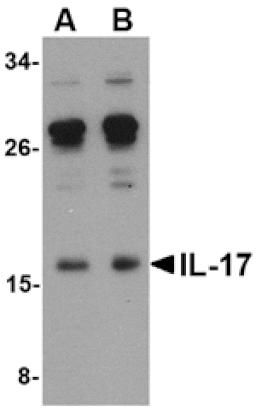 Western blot - IL-17 Antibody from Signalway Antibody (24789) - Antibodies.com
