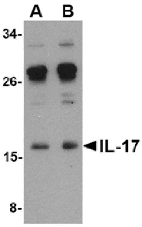 Western blot - IL-17 Antibody from Signalway Antibody (24789) - Antibodies.com