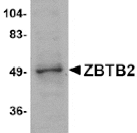 Western blot - ZBTB2 Antibody from Signalway Antibody (24812) - Antibodies.com