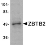 Western blot - ZBTB2 Antibody from Signalway Antibody (24812) - Antibodies.com