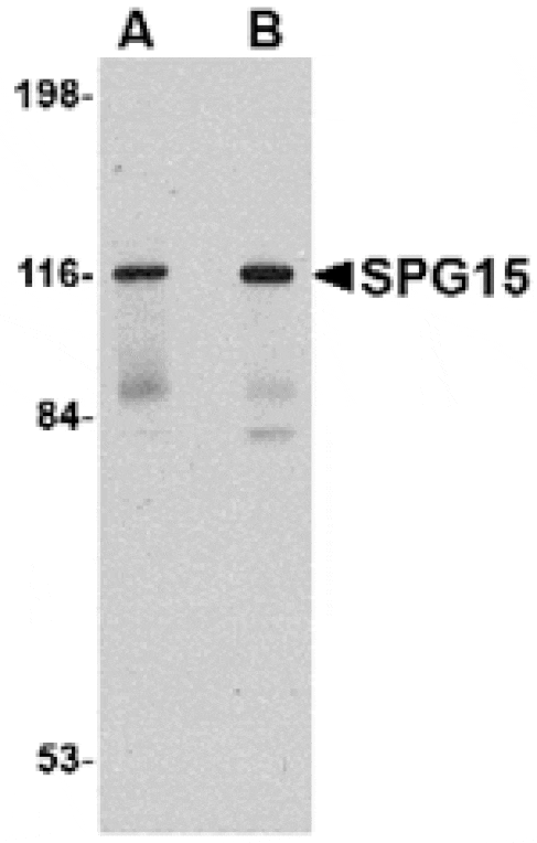 Western blot - SPG15 Antibody from Signalway Antibody (24839) - Antibodies.com