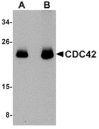 Western blot - CDC42 Antibody from Signalway Antibody (24863) - Antibodies.com