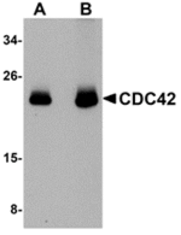 Western blot - CDC42 Antibody from Signalway Antibody (24863) - Antibodies.com