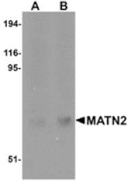 Western blot - MATN2 Antibody from Signalway Antibody (24865) - Antibodies.com
