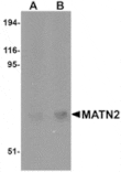 Western blot - MATN2 Antibody from Signalway Antibody (24865) - Antibodies.com