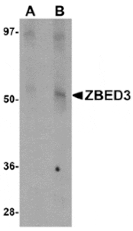 Western blot - ZBED3 Antibody from Signalway Antibody (24874) - Antibodies.com