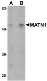 Western blot - MATN1 Antibody from Signalway Antibody (24881) - Antibodies.com