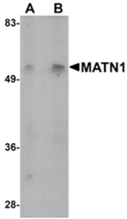 Western blot - MATN1 Antibody from Signalway Antibody (24881) - Antibodies.com