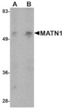 Western blot - MATN1 Antibody from Signalway Antibody (24881) - Antibodies.com