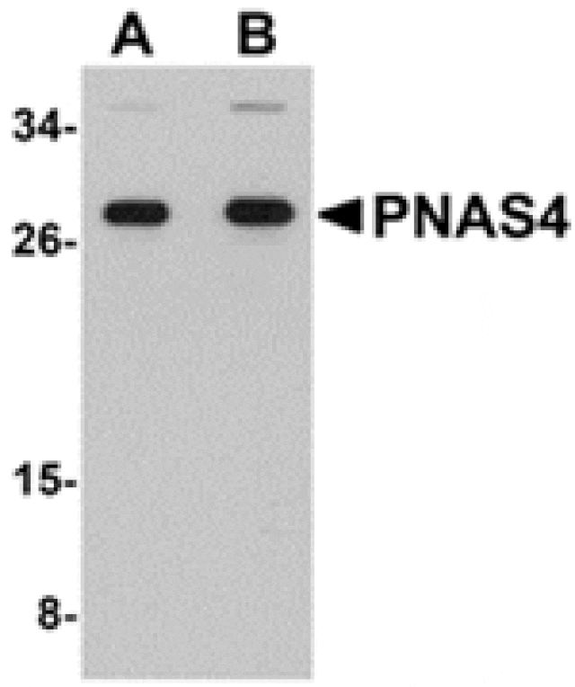 Western blot - PNAS4 Antibody from Signalway Antibody (24911) - Antibodies.com