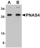 Western blot - PNAS4 Antibody from Signalway Antibody (24911) - Antibodies.com