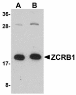 Western blot analysis of ZCRB1 in Raji cell lysate with ZCRB1 antibody at (A) 1 and (B) 2 µg/mL.