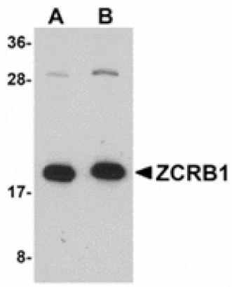 Western blot - ZCRB1 Antibody from Signalway Antibody (24915) - Antibodies.com