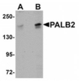 Western blot - PALB2 Antibody from Signalway Antibody (24938) - Antibodies.com