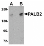Western blot - PALB2 Antibody from Signalway Antibody (24938) - Antibodies.com