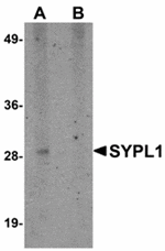 Western blot analysis of SYPL1 in human brain tissue lysate with SYPL1 antibody at 1 µg/mL in (A) the absence and (B) the presence of blocking peptide.
