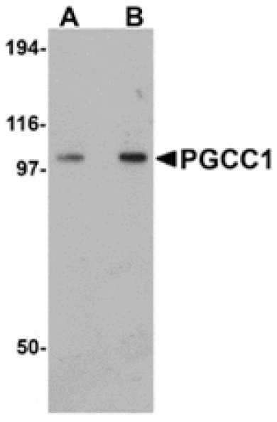 Western blot - PGCC1 Antibody from Signalway Antibody (24951) - Antibodies.com