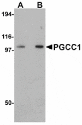 Western blot - PGCC1 Antibody from Signalway Antibody (24951) - Antibodies.com