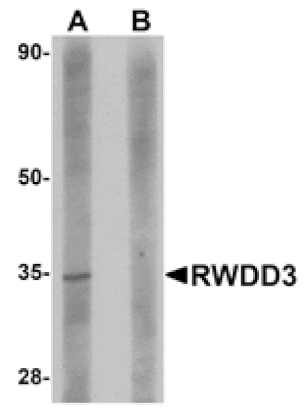 Western blot - RWDD3 Antibody from Signalway Antibody (24973) - Antibodies.com