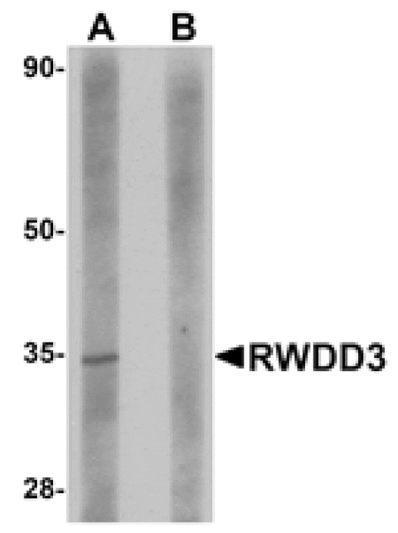 Western blot - RWDD3 Antibody from Signalway Antibody (24973) - Antibodies.com