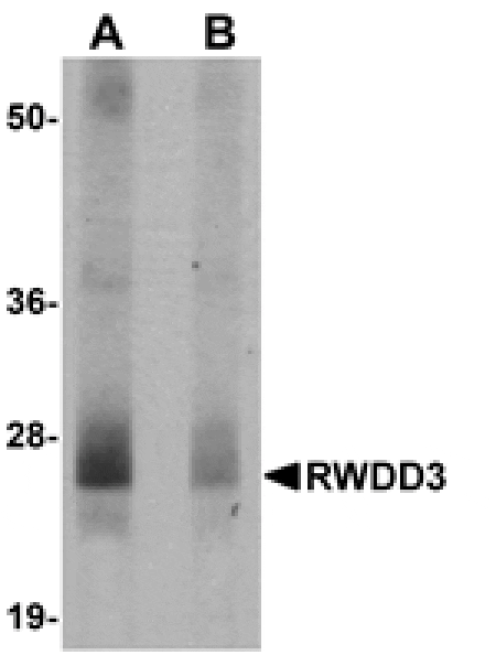 Western blot - RWDD3 Antibody from Signalway Antibody (24974) - Antibodies.com
