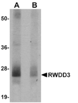 Western blot - RWDD3 Antibody from Signalway Antibody (24974) - Antibodies.com