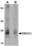 Western blot - RWDD3 Antibody from Signalway Antibody (24974) - Antibodies.com