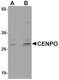 Western blot - CENPO Antibody from Signalway Antibody (24981) - Antibodies.com