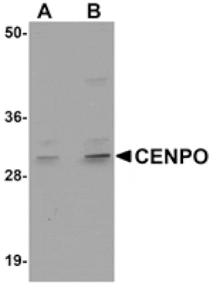 Western blot - CENPO Antibody from Signalway Antibody (24981) - Antibodies.com