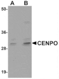 Western blot - CENPO Antibody from Signalway Antibody (24981) - Antibodies.com