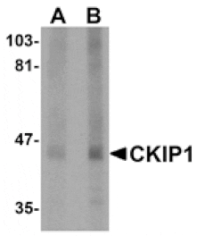 Western blot - CKIP1 Antibody from Signalway Antibody (24982) - Antibodies.com