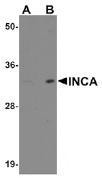 Western blot - INCA1 Antibody from Signalway Antibody (25023) - Antibodies.com