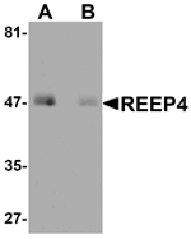 Western blot - REEP4 Antibody from Signalway Antibody (25040) - Antibodies.com