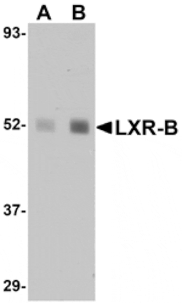 Western blot - LXR-B Antibody from Signalway Antibody (25042) - Antibodies.com