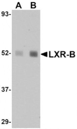 Western blot - LXR-B Antibody from Signalway Antibody (25042) - Antibodies.com