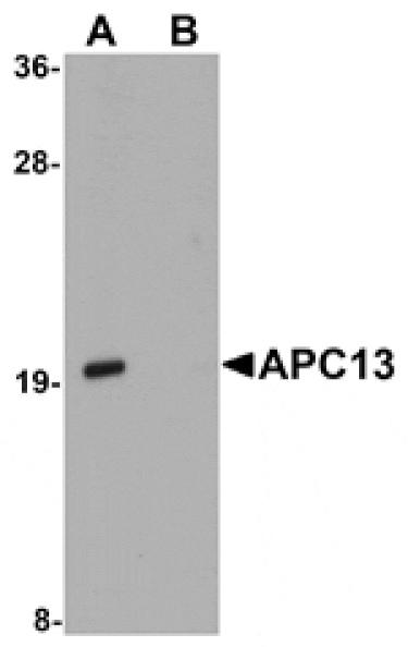 Western blot - APC13 Antibody from Signalway Antibody (25110) - Antibodies.com