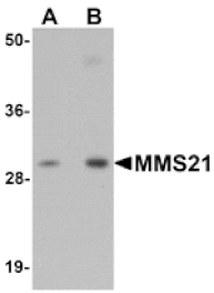 Western blot - MMS21 Antibody from Signalway Antibody (25119) - Antibodies.com