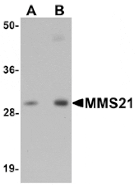 Western blot - MMS21 Antibody from Signalway Antibody (25119) - Antibodies.com