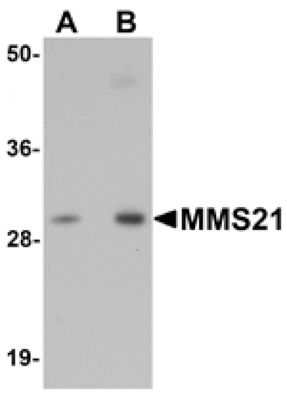 Western blot - MMS21 Antibody from Signalway Antibody (25119) - Antibodies.com