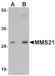 Western blot - MMS21 Antibody from Signalway Antibody (25119) - Antibodies.com