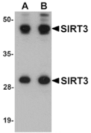 Western blot - SIRT3 Antibody from Signalway Antibody (25123) - Antibodies.com