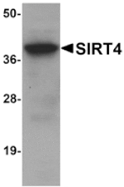 Western blot - SIRT4 Antibody from Signalway Antibody (25124) - Antibodies.com