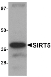 Western blot - SIRT5 Antibody from Signalway Antibody (25125) - Antibodies.com